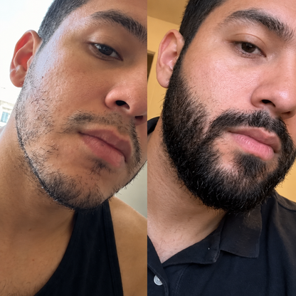 Apolo Ultra Potente™ | Bálsamo Estimulante para una Barba Más Densa y Definida